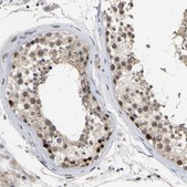 Anti-NLE1 antibody produced in rabbit Prestige Antibodies® Powered by Atlas Antibodies, affinity isolated antibody, buffered aqueous glycerol solution