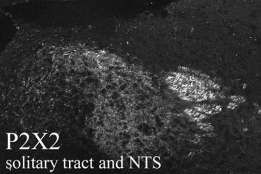 Anti-P2X2 Receptor Antibody serum, Chemicon&#174;