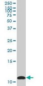 Anti-S100A10 antibody produced in mouse purified immunoglobulin, buffered aqueous solution