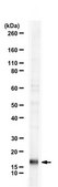 Anti-UBE2A from rabbit, purified by affinity chromatography