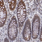 Anti-DDX24 antibody produced in rabbit Prestige Antibodies® Powered by Atlas Antibodies, affinity isolated antibody, buffered aqueous glycerol solution