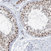 Anti-TREX1 antibody produced in rabbit Prestige Antibodies® Powered by Atlas Antibodies, affinity isolated antibody, buffered aqueous glycerol solution