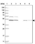 Anti-RBM34 antibody produced in rabbit Prestige Antibodies® Powered by Atlas Antibodies, affinity isolated antibody, buffered aqueous glycerol solution