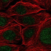 Anti-PRPF38A antibody produced in rabbit Prestige Antibodies® Powered by Atlas Antibodies, affinity isolated antibody, buffered aqueous glycerol solution