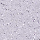 Anti-MOBP antibody produced in rabbit Prestige Antibodies® Powered by Atlas Antibodies, affinity isolated antibody, buffered aqueous glycerol solution