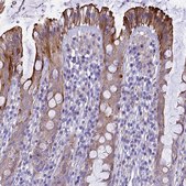 Anti-NOD2 antibody produced in rabbit Prestige Antibodies® Powered by Atlas Antibodies, affinity isolated antibody, buffered aqueous glycerol solution