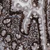 Monoclonal Anti-HNRNPC antibody produced in mouse Prestige Antibodies® Powered by Atlas Antibodies, clone CL2593, purified immunoglobulin, buffered aqueous glycerol solution