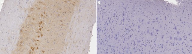 Anti-Choline Transporter Antibody from rabbit, purified by affinity chromatography