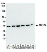Rabbit anti-PPP1CA Antibody, Affinity Purified Powered by Bethyl Laboratories, Inc.