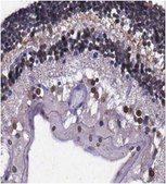 Anti-RanBP2 Antibody from rabbit, purified by affinity chromatography