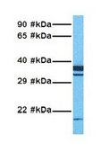 Anti-DDIT4L antibody produced in rabbit affinity isolated antibody