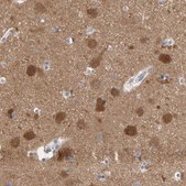 Anti-NCDN antibody produced in rabbit Prestige Antibodies® Powered by Atlas Antibodies, affinity isolated antibody, buffered aqueous glycerol solution