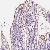 Anti-SLC5A12 antibody produced in rabbit Prestige Antibodies® Powered by Atlas Antibodies, affinity isolated antibody, buffered aqueous glycerol solution