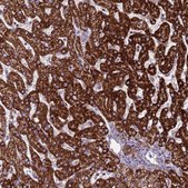 Anti-GCDH antibody produced in rabbit Prestige Antibodies® Powered by Atlas Antibodies, affinity isolated antibody, buffered aqueous glycerol solution