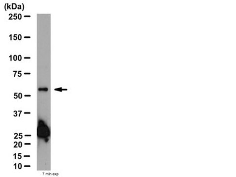 Anti-Nicotinic Acetylcholine Receptor &#946;2 Antibody from rabbit, purified by affinity chromatography