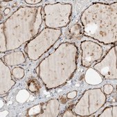 Anti-CMTM4 antibody produced in rabbit Prestige Antibodies® Powered by Atlas Antibodies, affinity isolated antibody, buffered aqueous glycerol solution