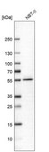 Anti-ALDH9A1 antibody produced in rabbit Prestige Antibodies® Powered by Atlas Antibodies, affinity isolated antibody, buffered aqueous glycerol solution