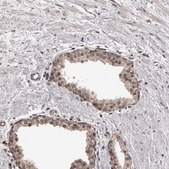 Anti-VPS37A antibody produced in rabbit Prestige Antibodies® Powered by Atlas Antibodies, affinity isolated antibody, buffered aqueous glycerol solution, ab1