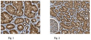 Anti-NSD2 Antibody from rabbit, purified by affinity chromatography