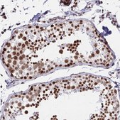 Anti-YTHDF2 antibody produced in rabbit Prestige Antibodies® Powered by Atlas Antibodies, affinity isolated antibody, buffered aqueous glycerol solution
