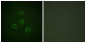 Anti-PP2A-α antibody produced in rabbit affinity isolated antibody