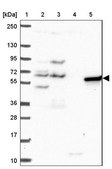Anti-PAK3 antibody produced in rabbit Prestige Antibodies® Powered by Atlas Antibodies, affinity isolated antibody, buffered aqueous glycerol solution
