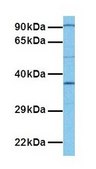 Anti-TNMD (ab1) antibody produced in rabbit affinity isolated antibody