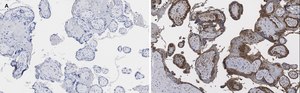 Anti-BCRP (ABCG2) Antibody, clone 10K5 , ZooMAb® Rabbit Monoclonal recombinant, expressed in HEK 293 cells