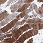 Anti-PPP1R3A antibody produced in rabbit Prestige Antibodies® Powered by Atlas Antibodies, affinity isolated antibody, buffered aqueous glycerol solution