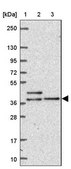 Anti-DYNC2LI1 antibody produced in rabbit Prestige Antibodies® Powered by Atlas Antibodies, affinity isolated antibody, buffered aqueous glycerol solution