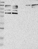 Anti-PARP3 antibody produced in rabbit Prestige Antibodies® Powered by Atlas Antibodies, affinity isolated antibody, buffered aqueous glycerol solution