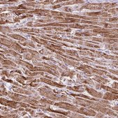 Anti-DLAT antibody produced in rabbit Prestige Antibodies® Powered by Atlas Antibodies, affinity isolated antibody, buffered aqueous glycerol solution