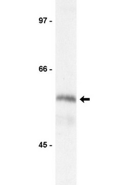 Anti-Kip2 Antibody Upstate&#174;, from rabbit