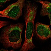 Anti-THNSL1 antibody produced in rabbit Prestige Antibodies® Powered by Atlas Antibodies, affinity isolated antibody, buffered aqueous glycerol solution