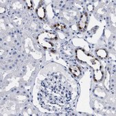 Anti-ATP6V0A4 antibody produced in rabbit Prestige Antibodies® Powered by Atlas Antibodies, affinity isolated antibody, buffered aqueous glycerol solution