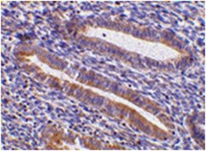 Anti-TIM-1 Antibody from rabbit, purified by affinity chromatography