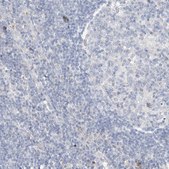 Anti-DNAH5 antibody produced in rabbit Prestige Antibodies® Powered by Atlas Antibodies, affinity isolated antibody, buffered aqueous glycerol solution