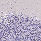 Anti-BTN1A1 antibody produced in rabbit Prestige Antibodies® Powered by Atlas Antibodies, affinity isolated antibody, buffered aqueous glycerol solution
