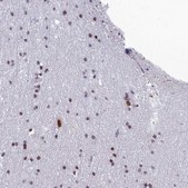 Anti-RSRC1 antibody produced in rabbit Prestige Antibodies® Powered by Atlas Antibodies, affinity isolated antibody, buffered aqueous glycerol solution