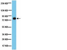 Anti-phospho-MARCKS (Ser152/156) Antibody from rabbit, purified by affinity chromatography