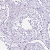 Anti-SLC4A4 antibody produced in rabbit Prestige Antibodies® Powered by Atlas Antibodies, affinity isolated antibody, buffered aqueous glycerol solution