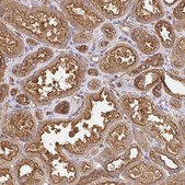 Anti-CTTN antibody produced in rabbit Prestige Antibodies® Powered by Atlas Antibodies, affinity isolated antibody, buffered aqueous glycerol solution