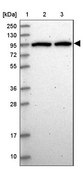Anti-DDX27 antibody produced in rabbit Prestige Antibodies® Powered by Atlas Antibodies, affinity isolated antibody, buffered aqueous glycerol solution