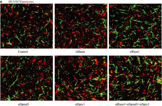 Anti-Spred-1 Antibody from rabbit, purified by affinity chromatography