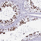 Anti-SUGP2 antibody produced in rabbit Prestige Antibodies® Powered by Atlas Antibodies, affinity isolated antibody, buffered aqueous glycerol solution