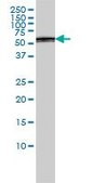 Monoclonal Anti-PSMD5 antibody produced in mouse clone 3E2, purified immunoglobulin, buffered aqueous solution