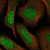 Anti-PPM1F antibody produced in rabbit Prestige Antibodies® Powered by Atlas Antibodies, affinity isolated antibody, buffered aqueous glycerol solution
