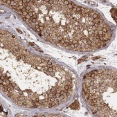 Monoclonal Anti-VPS26A antibody produced in mouse Prestige Antibodies® Powered by Atlas Antibodies, clone CL2287, purified immunoglobulin, buffered aqueous glycerol solution