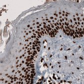Monoclonal Anti-PARP1 Prestige Antibodies® Powered by Atlas Antibodies, clone CL2209, purified immunoglobulin, buffered aqueous glycerol solution