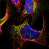 Anti-SMYD5 antibody produced in rabbit Prestige Antibodies® Powered by Atlas Antibodies, affinity isolated antibody, buffered aqueous glycerol solution